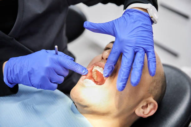 Tooth Infection Emergency Dentist in MD